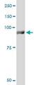 Glycogen Phosphorylase, Muscle Associated antibody, ab88078, Abcam, Western Blot image 