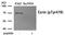 Ezrin antibody, 79-960, ProSci, Western Blot image 