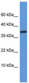 Vestigial Like Family Member 2 antibody, TA339813, Origene, Western Blot image 