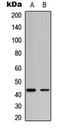 JunB Proto-Oncogene, AP-1 Transcription Factor Subunit antibody, LS-C356141, Lifespan Biosciences, Western Blot image 