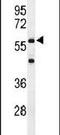 Interleukin 2 Receptor Subunit Gamma antibody, PA5-26461, Invitrogen Antibodies, Western Blot image 