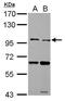 Toll Like Receptor 5 antibody, PA5-27738, Invitrogen Antibodies, Western Blot image 