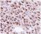 RAD51 Recombinase antibody, MA1-23271, Invitrogen Antibodies, Immunohistochemistry paraffin image 
