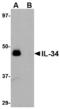 Interleukin 34 antibody, LS-C83914, Lifespan Biosciences, Western Blot image 