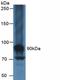 Mucin 16, Cell Surface Associated antibody, LS-C293127, Lifespan Biosciences, Western Blot image 