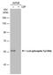 LCK Proto-Oncogene, Src Family Tyrosine Kinase antibody, PA5-78038, Invitrogen Antibodies, Western Blot image 