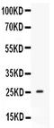 Prolactin antibody, RP1021, Boster Biological Technology, Western Blot image 