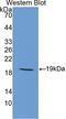 Interleukin 1 Receptor Antagonist antibody, LS-C294798, Lifespan Biosciences, Western Blot image 