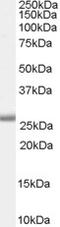 Survival Of Motor Neuron 2, Centromeric antibody, LS-C55487, Lifespan Biosciences, Western Blot image 