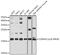 Cyclin Dependent Kinase Inhibitor 2C antibody, GTX55735, GeneTex, Western Blot image 