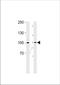 Ribosomal Protein S6 Kinase A3 antibody, TA325008, Origene, Western Blot image 