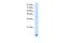 Mohawk Homeobox antibody, A12889, Boster Biological Technology, Western Blot image 