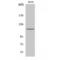 Protein Kinase D1 antibody, LS-C385554, Lifespan Biosciences, Western Blot image 