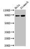 N-Acylsphingosine Amidohydrolase 2 antibody, CSB-PA002170EA01HU, Cusabio, Western Blot image 
