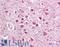 CCAAT Enhancer Binding Protein Gamma antibody, LS-B6470, Lifespan Biosciences, Immunohistochemistry paraffin image 