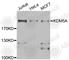 Lysine Demethylase 5A antibody, A7238, ABclonal Technology, Western Blot image 