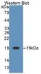 Killer Cell Lectin Like Receptor K1 antibody, LS-C374223, Lifespan Biosciences, Western Blot image 