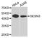 Sestrin 3 antibody, A5164, ABclonal Technology, Western Blot image 