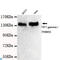 Tripartite Motif Containing 33 antibody, LS-C813137, Lifespan Biosciences, Western Blot image 