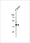 Phosphatidylinositol-4-Phosphate 5-Kinase Type 1 Gamma antibody, 63-363, ProSci, Western Blot image 