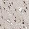 Prefoldin Subunit 1 antibody, NBP1-87294, Novus Biologicals, Immunohistochemistry frozen image 