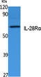 Interferon Lambda Receptor 1 antibody, A05986, Boster Biological Technology, Western Blot image 