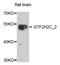 GTF2H2 Family Member C, Copy 2 antibody, STJ110596, St John