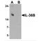 Interleukin 36 Beta antibody, MBS153331, MyBioSource, Western Blot image 