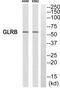 Glycine Receptor Beta antibody, PA5-39191, Invitrogen Antibodies, Western Blot image 
