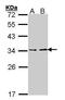 ATPase H+ Transporting V1 Subunit E1 antibody, PA5-34668, Invitrogen Antibodies, Western Blot image 