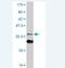 HIC ZBTB Transcriptional Repressor 1 antibody, H00003090-M06, Novus Biologicals, Western Blot image 