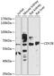 Chromodomain Y-Linked 2B antibody, 14-571, ProSci, Western Blot image 