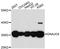 DnaJ Heat Shock Protein Family (Hsp40) Member C9 antibody, A13176, ABclonal Technology, Western Blot image 