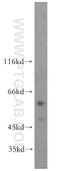 Scm Polycomb Group Protein Homolog 1 antibody, 11489-1-AP, Proteintech Group, Western Blot image 