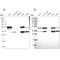 Citrate Lyase Beta Like antibody, PA5-59251, Invitrogen Antibodies, Western Blot image 