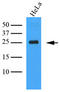 C-Type Lectin Domain Family 4 Member E antibody, AM09361PU-S, Origene, Western Blot image 