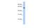 Tektin 4 antibody, A11966, Boster Biological Technology, Western Blot image 