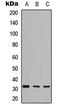 Glutamate-Cysteine Ligase Modifier Subunit antibody, LS-C356059, Lifespan Biosciences, Western Blot image 