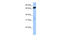 Zinc Finger And BTB Domain Containing 46 antibody, 30-649, ProSci, Enzyme Linked Immunosorbent Assay image 