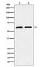 Caseinolytic Mitochondrial Matrix Peptidase Chaperone Subunit antibody, M00978-1, Boster Biological Technology, Western Blot image 