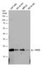 Superoxide Dismutase 2 antibody, GTX103230, GeneTex, Western Blot image 