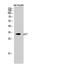 Cyclin Dependent Kinase Inhibitor 1C antibody, STJ94910, St John