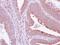 GRB2 Related Adaptor Protein antibody, GTX115471, GeneTex, Immunohistochemistry paraffin image 