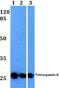 Tetraspanin 8 antibody, A06997S129, Boster Biological Technology, Western Blot image 