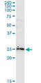 BCL2L2-PABPN1 Readthrough antibody, LS-C196738, Lifespan Biosciences, Western Blot image 