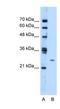 Transmembrane Protein 126B antibody, NBP1-59978, Novus Biologicals, Western Blot image 