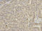 Glutamate Ionotropic Receptor AMPA Type Subunit 3 antibody, LS-C331307, Lifespan Biosciences, Immunohistochemistry paraffin image 