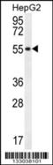 UDP-Glucuronate Decarboxylase 1 antibody, MBS9214081, MyBioSource, Western Blot image 