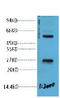 EF-hand domain-containing protein D1 antibody, STJ97096, St John