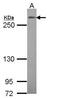 Notch Receptor 3 antibody, PA5-28082, Invitrogen Antibodies, Western Blot image 